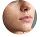 Hydrates and protects